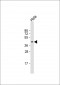 NUDT9 Antibody (C-term)